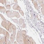 DENND2C Antibody in Immunohistochemistry (Paraffin) (IHC (P))