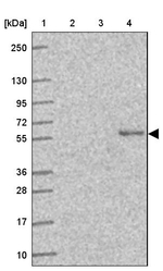 SLC29A3 Antibody in Western Blot (WB)