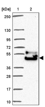 FAM149A Antibody in Western Blot (WB)