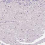 FOCAD Antibody in Immunohistochemistry (Paraffin) (IHC (P))