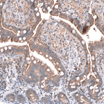 FOCAD Antibody in Immunohistochemistry (Paraffin) (IHC (P))