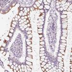 FOCAD Antibody in Immunohistochemistry (Paraffin) (IHC (P))