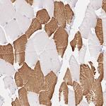 FOCAD Antibody in Immunohistochemistry (Paraffin) (IHC (P))