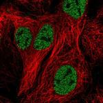 ZNF607 Antibody in Immunocytochemistry (ICC/IF)