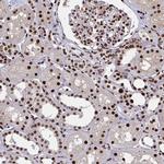 ZNF607 Antibody in Immunohistochemistry (IHC)