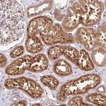 UBE4a Antibody in Immunohistochemistry (Paraffin) (IHC (P))