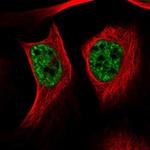 UBE4a Polyclonal Antibody