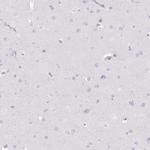 DCAF17 Antibody in Immunohistochemistry (IHC)