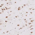 RPS17 Antibody in Immunohistochemistry (Paraffin) (IHC (P))