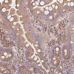 RPS17 Antibody in Immunohistochemistry (Paraffin) (IHC (P))