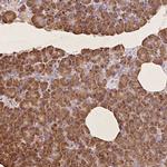 RPS17 Antibody in Immunohistochemistry (Paraffin) (IHC (P))