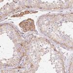 RPS17 Antibody in Immunohistochemistry (Paraffin) (IHC (P))