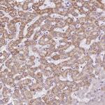 TMEM170A Polyclonal Antibody