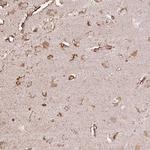 LRTM2 Polyclonal Antibody