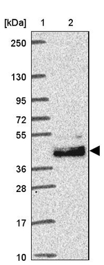 LRTM2 Antibody in Western Blot (WB)