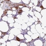 ESPNL Polyclonal Antibody