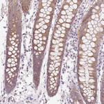 OMA1 Antibody in Immunohistochemistry (Paraffin) (IHC (P))