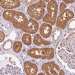 OMA1 Antibody in Immunohistochemistry (Paraffin) (IHC (P))