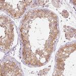 OMA1 Antibody in Immunohistochemistry (Paraffin) (IHC (P))