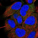 CCDC28A Polyclonal Antibody