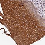 CCDC28A Antibody in Immunohistochemistry (Paraffin) (IHC (P))