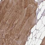 ZNF498 Antibody in Immunohistochemistry (Paraffin) (IHC (P))