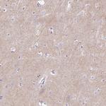 PRRT1 Polyclonal Antibody
