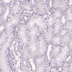 PRM1 Antibody in Immunohistochemistry (IHC)