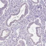 PRM1 Antibody in Immunohistochemistry (IHC)