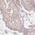 TMEM151B Antibody in Immunohistochemistry (Paraffin) (IHC (P))
