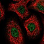 TTC9C Polyclonal Antibody