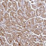TTC9C Antibody in Immunohistochemistry (Paraffin) (IHC (P))