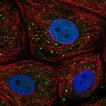 MSMP Polyclonal Antibody