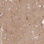 MSMP Antibody in Immunohistochemistry (Paraffin) (IHC (P))