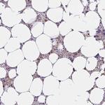 ABCB10 Polyclonal Antibody