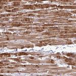 SYNPO2L Antibody in Immunohistochemistry (IHC)