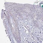 SYNPO2L Antibody in Immunohistochemistry (IHC)