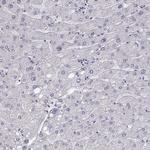 Cytokeratin 31 Antibody in Immunohistochemistry (Paraffin) (IHC (P))