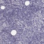 Cytokeratin 31 Polyclonal Antibody