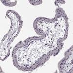 Cytokeratin 31 Antibody in Immunohistochemistry (Paraffin) (IHC (P))