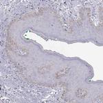 Cytokeratin 31 Antibody in Immunohistochemistry (Paraffin) (IHC (P))