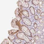 SLC25A40 Polyclonal Antibody