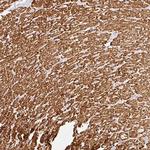 BBIP1 Polyclonal Antibody
