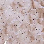 USP35 Antibody in Immunohistochemistry (Paraffin) (IHC (P))