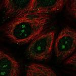 TMEM79 Polyclonal Antibody