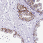 TMEM79 Antibody in Immunohistochemistry (Paraffin) (IHC (P))