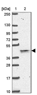 TMEM79 Antibody in Western Blot (WB)