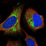 ITPK1 Polyclonal Antibody