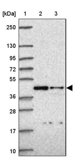 ITPK1 Antibody in Western Blot (WB)