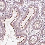 OR8K1 Polyclonal Antibody